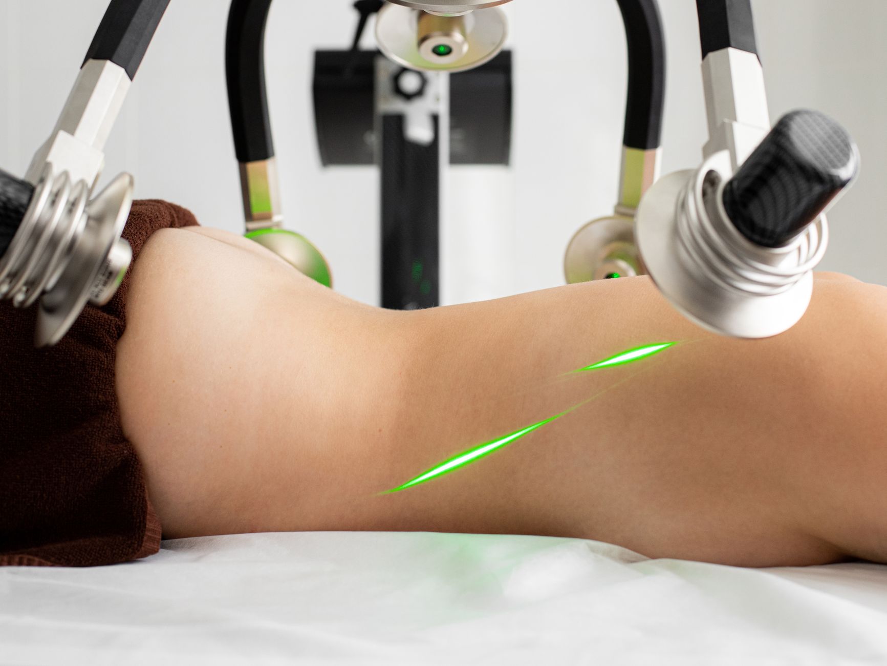 Multifunction cavitation and radiofrequency body contouring system with handles