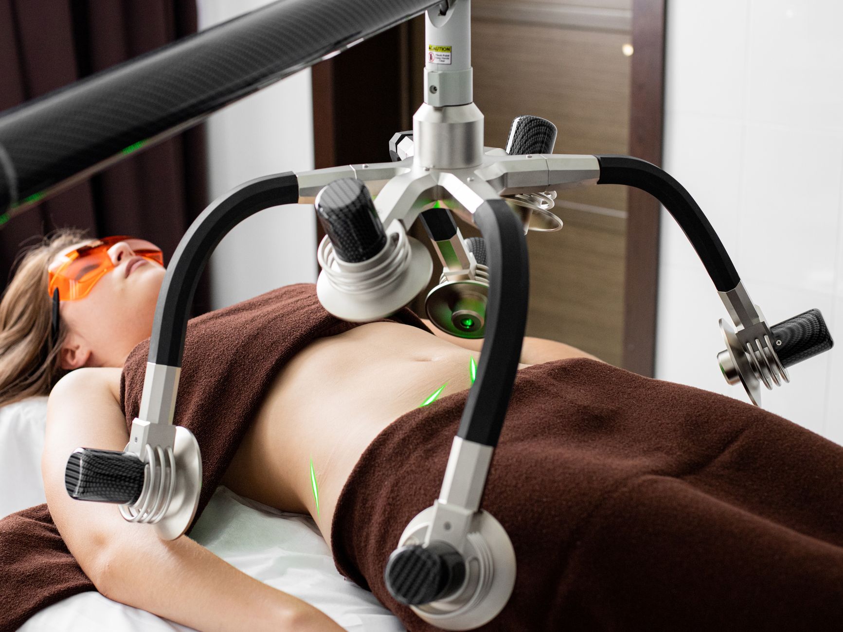 Client receiving a HIFEM muscle stimulation treatment on the abdomen
